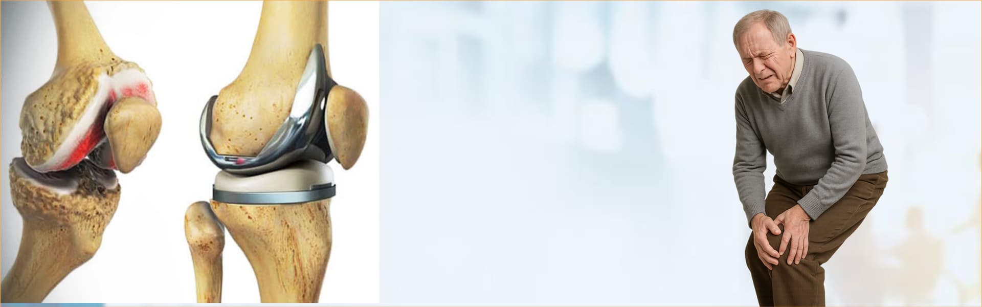 Joint Replacements & Orthopedic